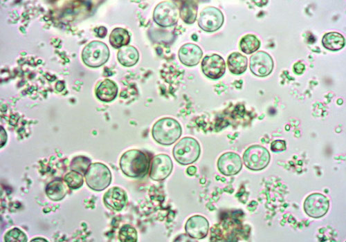 Piramide Ambiente - Definizione con microscopii