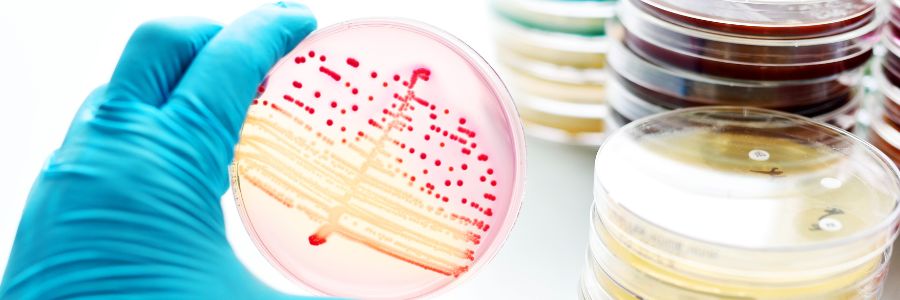 Diffusione da Pseudomonas